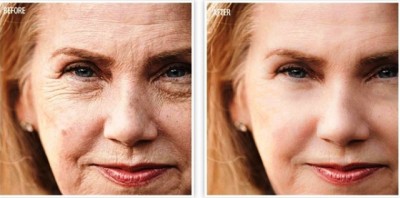 Skin Anti Aging