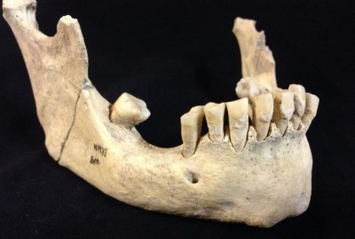 1568184815milk-in-thousand-yrs-old-teeth.jpg