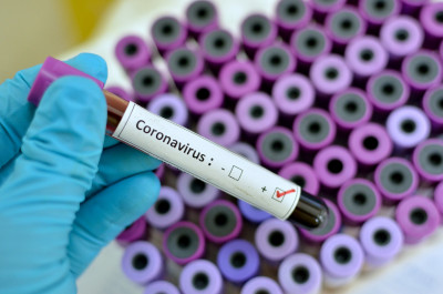 1582989794coronavirus-vial.jpg