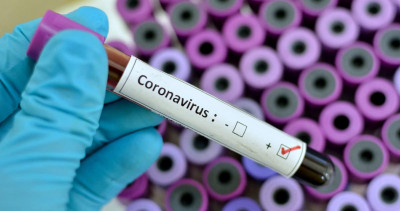 सेरोसर्भेलेन्स नतिजा : ३० लाख नेपाली कोरोनाबाट संक्रमित भइसकेको अनुमान, घरमै बसेका १०%